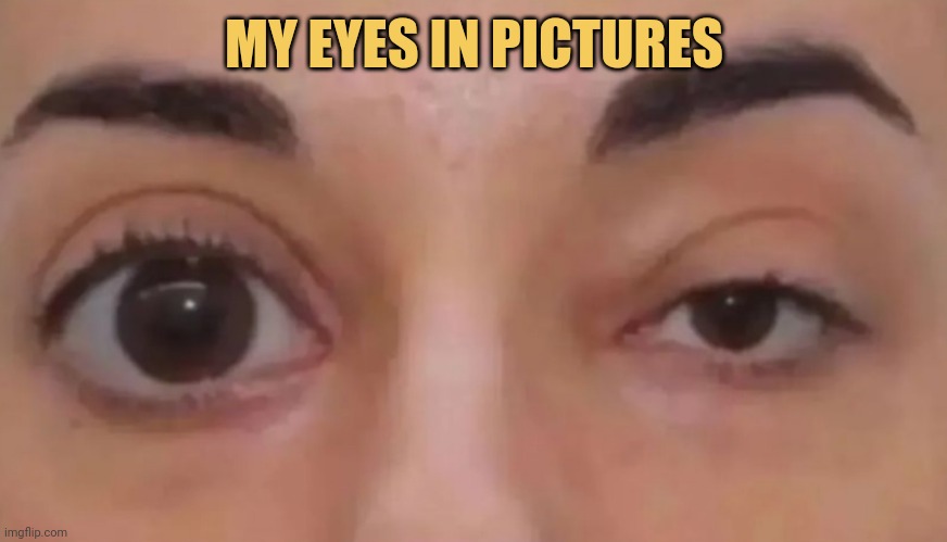 MY eyes in pictures 